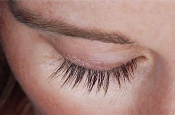 Is Latisse eyelash serum safe for your eyes?