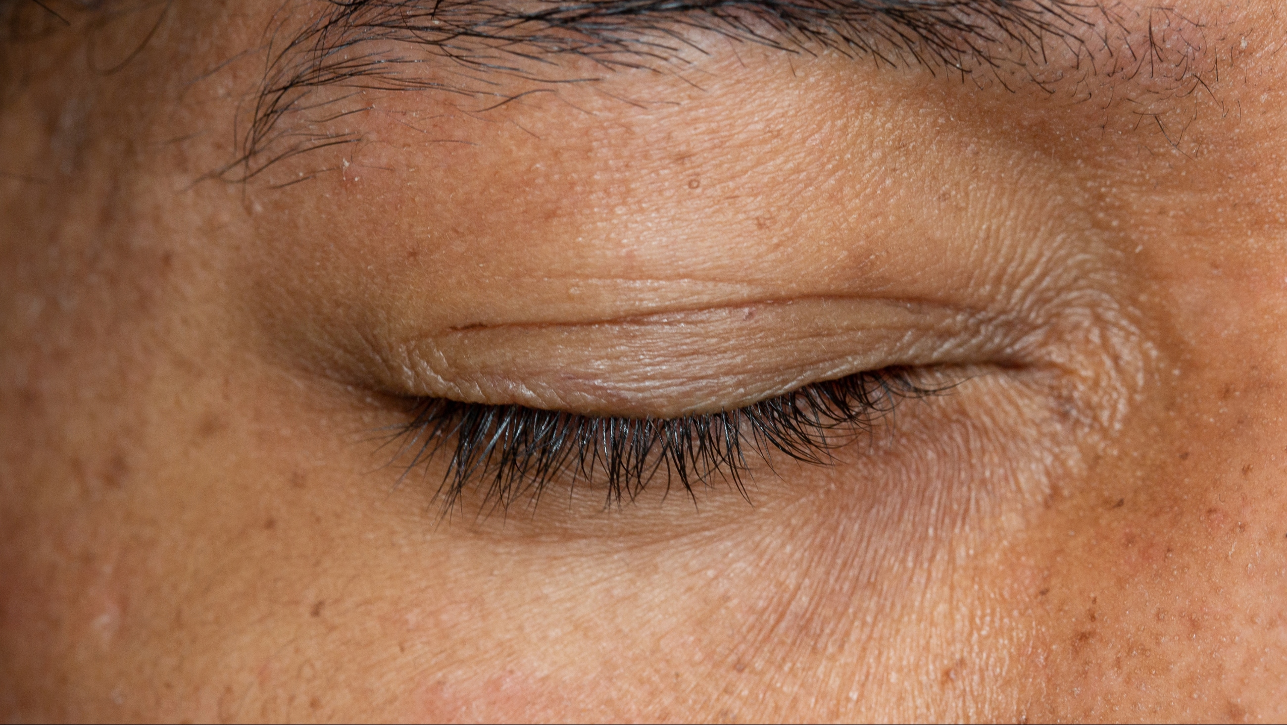 Eyelid: Parts of the eyelid and how they work Eyelid: Parts of the eyelid and how they work