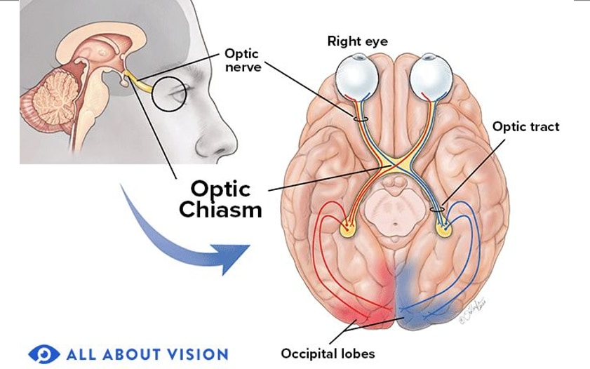 medical illustration of the optic chiasm in the brain