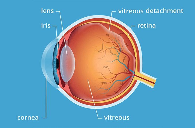 Vitreous humor: Gel of the eye