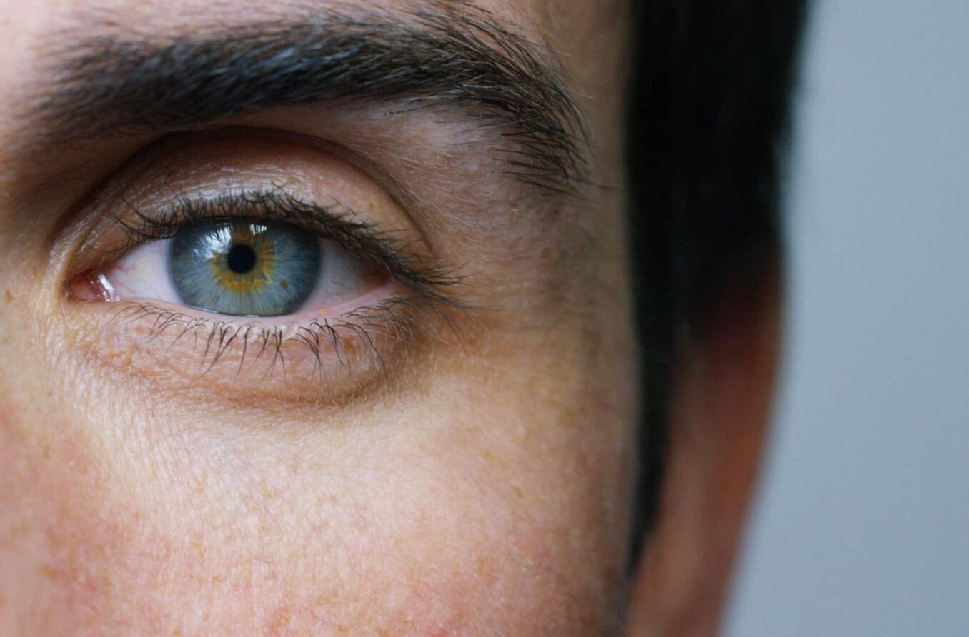 Retinal vasculitis (RV): Causes, symptoms and treatment Retinal vasculitis (RV): Causes, symptoms and treatment