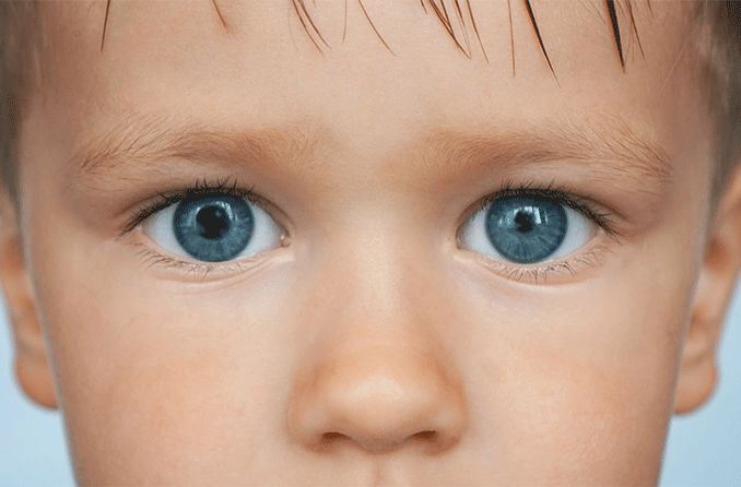 Anisocoria: What causes unequal pupil sizes?