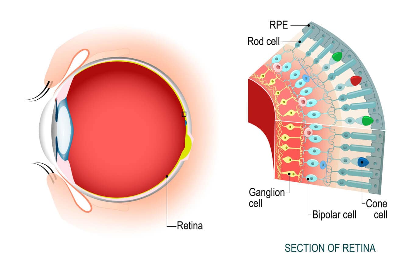 Commotio retinae