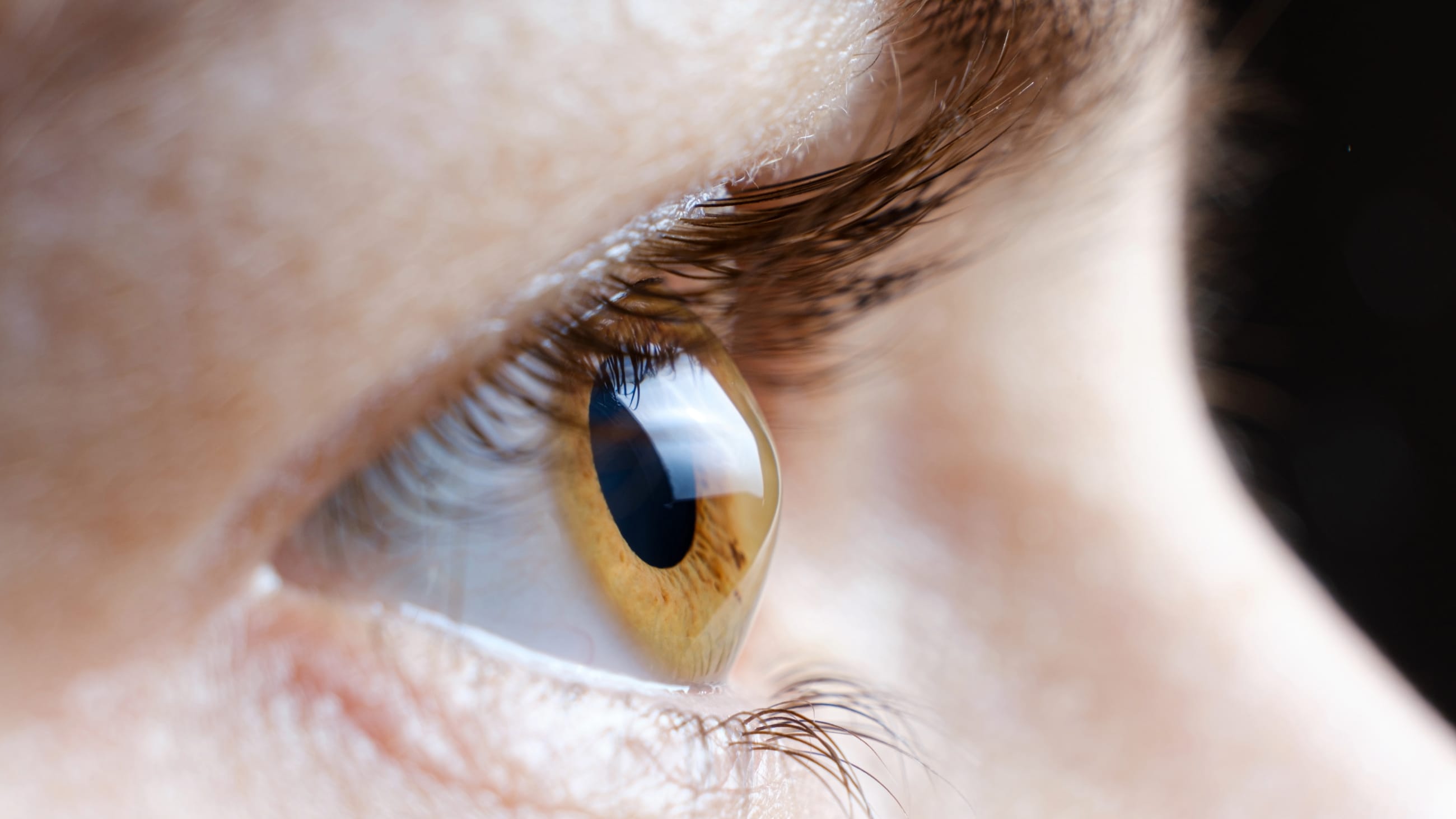 Corneal ectasia: Causes, symptoms and treatment