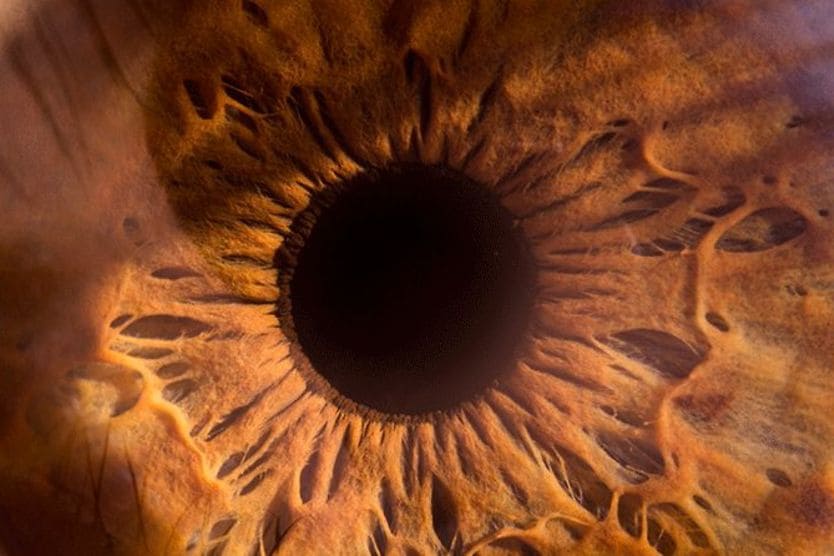 closeup of an eyeball with globe luxation closeup of an eyeball with globe luxation