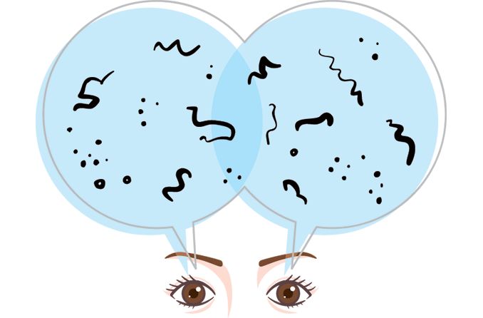 Is it normal for young people with myopia to have eye floaters? Is it normal for young people with myopia to have eye floaters?