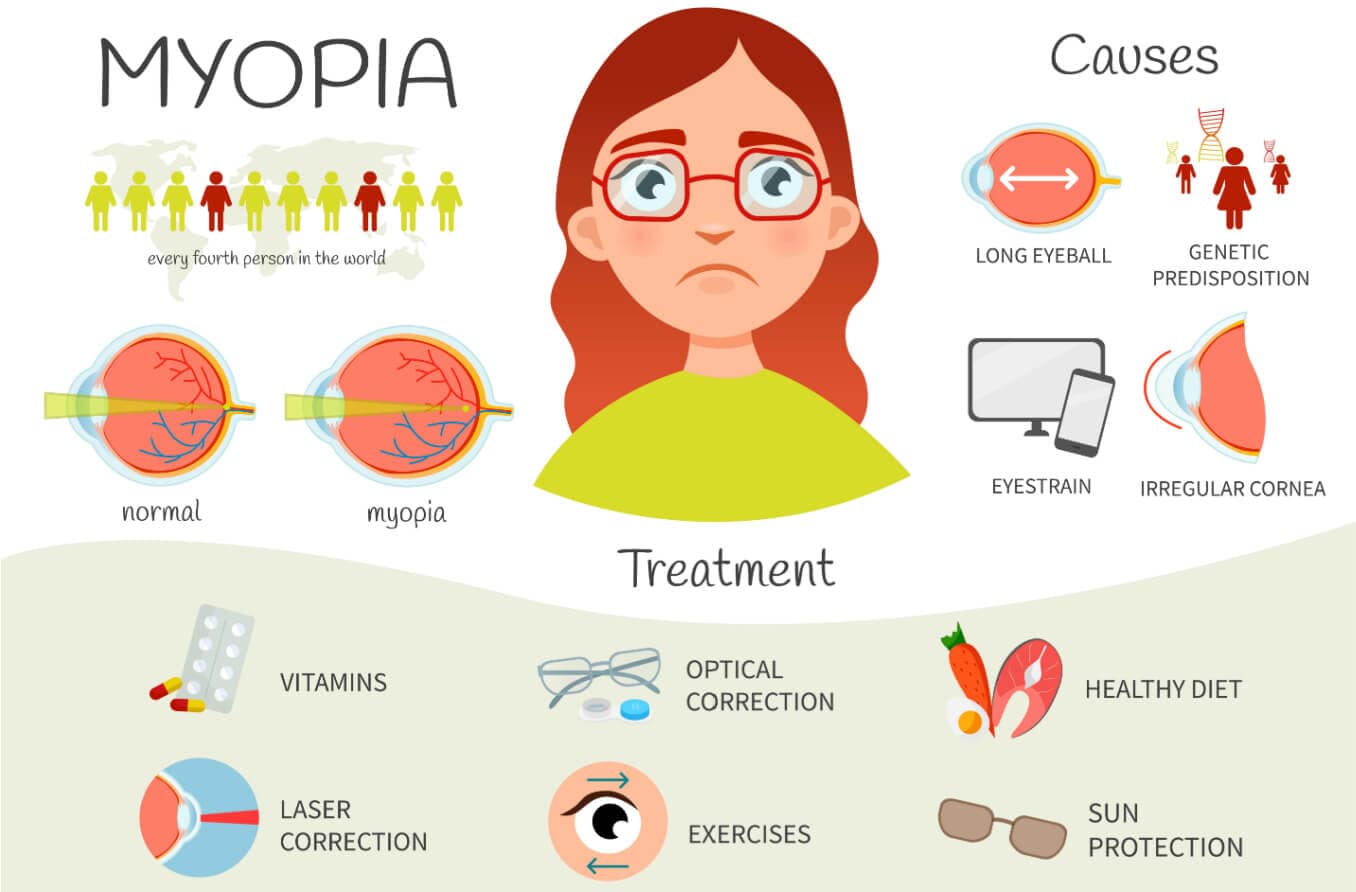 Types of myopia and the increased risk of eye complications