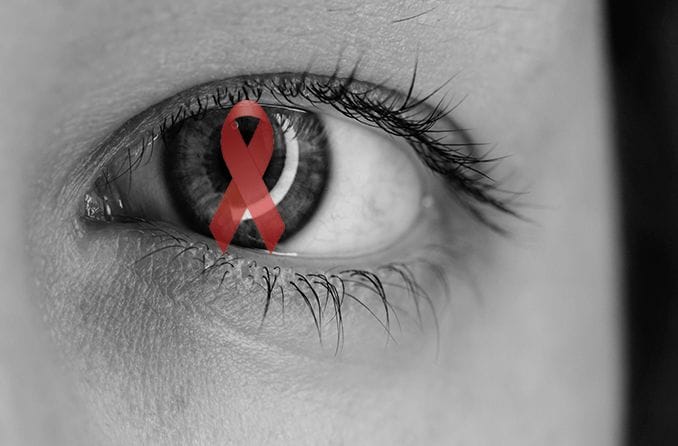 HIV retinopathy and HIV-related eye problems