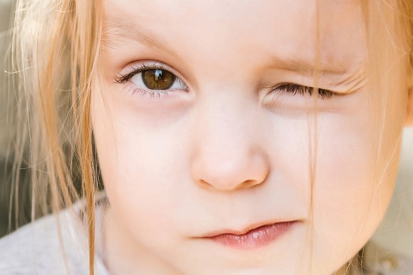girl squinting and closing one eye due to pediatric astigmatism
