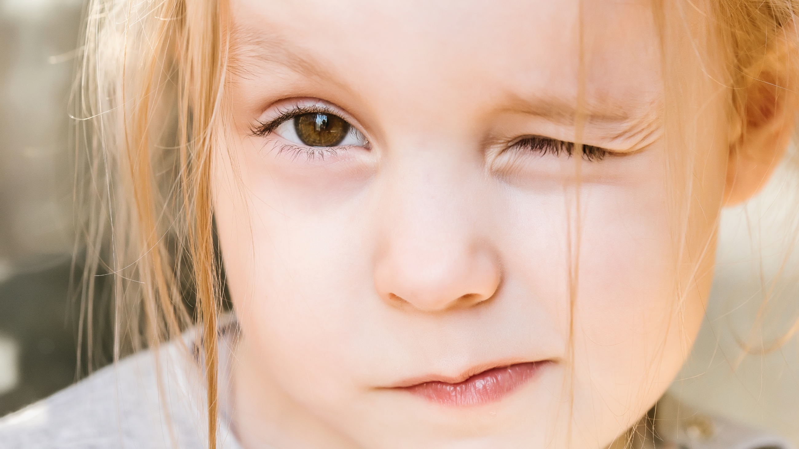 Astigmatism in infants and kids Astigmatism in infants and kids
