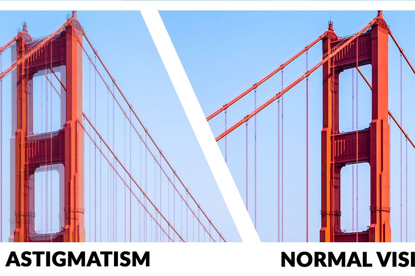 astigmatism vs. normal vision astigmatism vs. normal vision