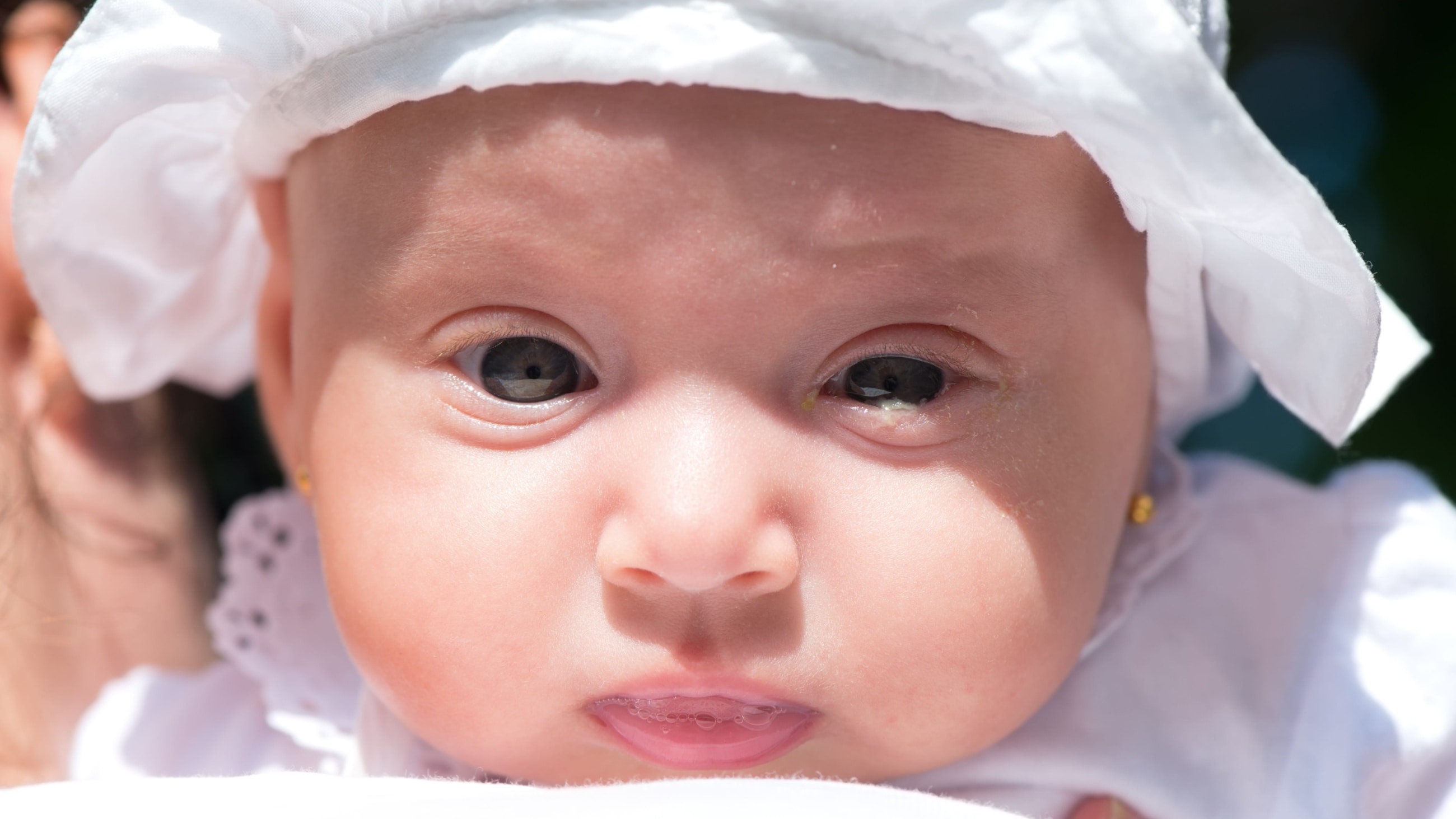 baby with blocked tear duct baby with blocked tear duct