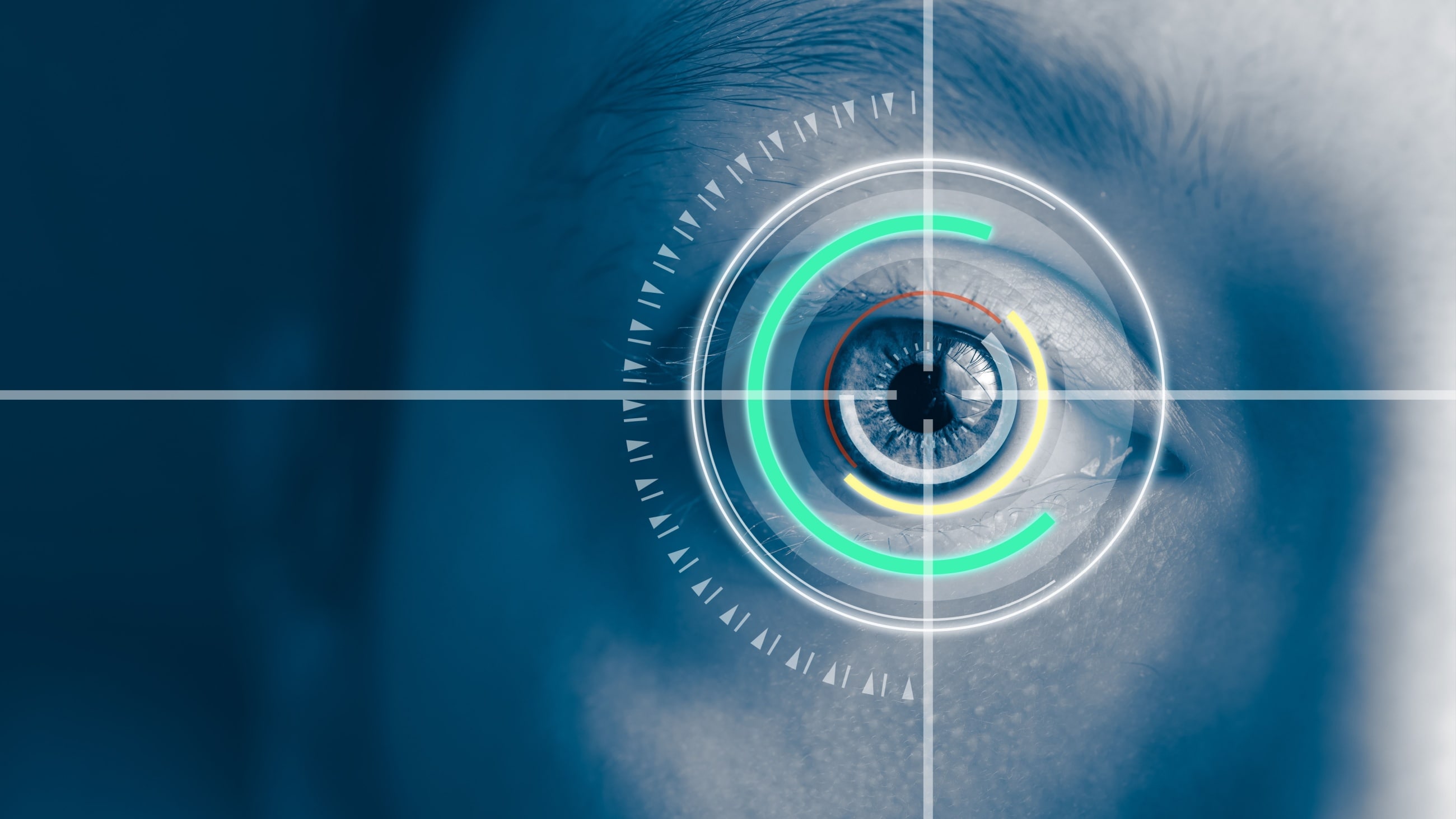 Illustration of a normal eye v eye with glaucoma.