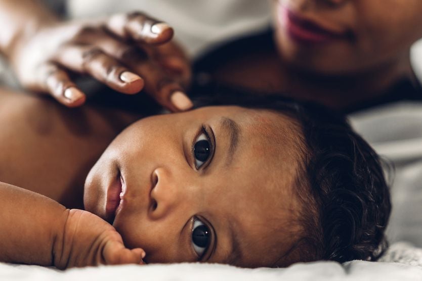 baby with congenital glaucoma
