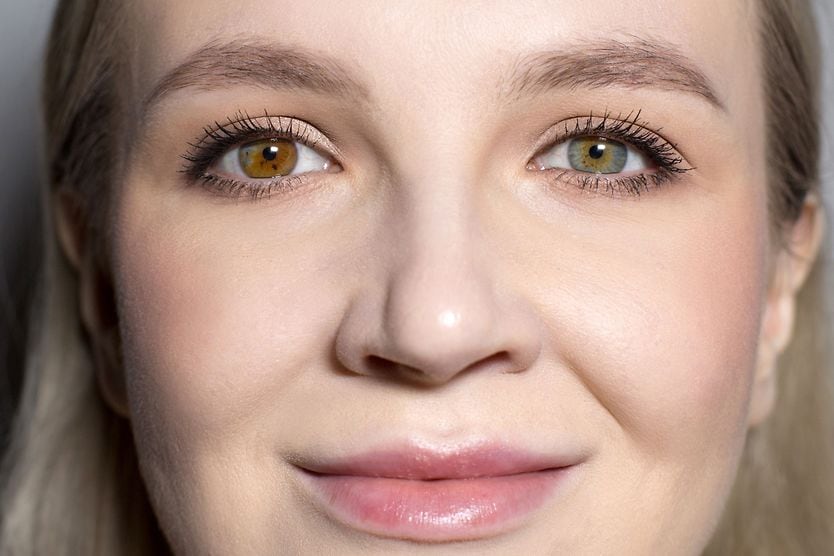Kate Bosworth celebrity with heterochromia