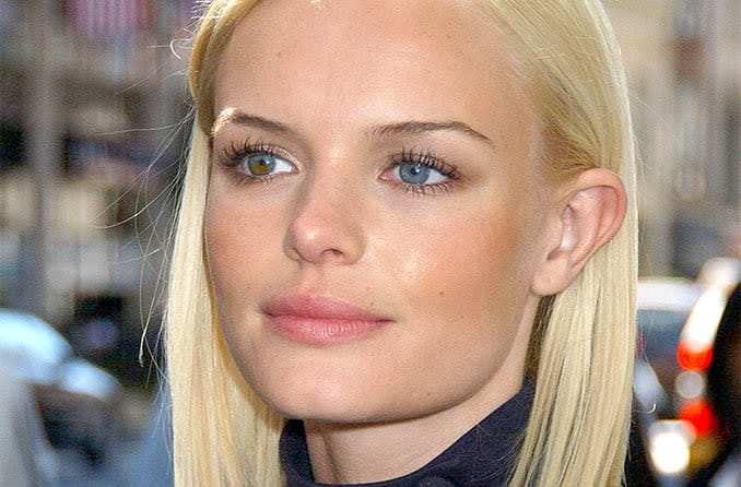 Celebrities with different-colored eyes (heterochromia)