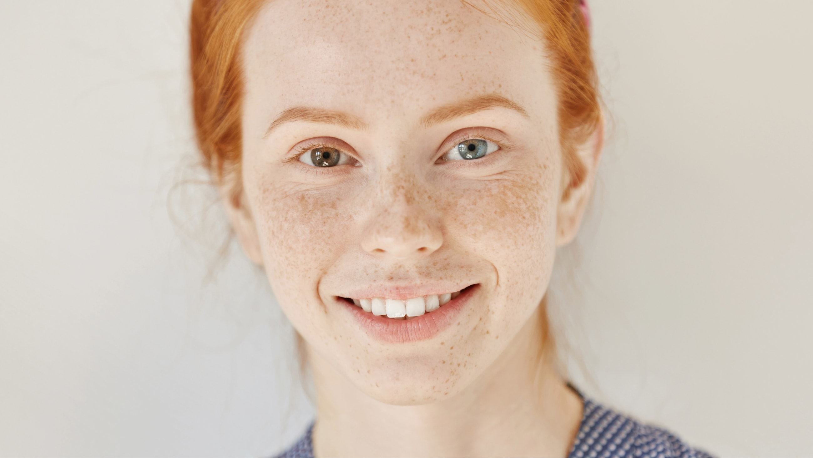 Heterochromia is having different-colored eyes Heterochromia is having different-colored eyes