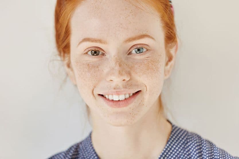 Girl with heterochromia