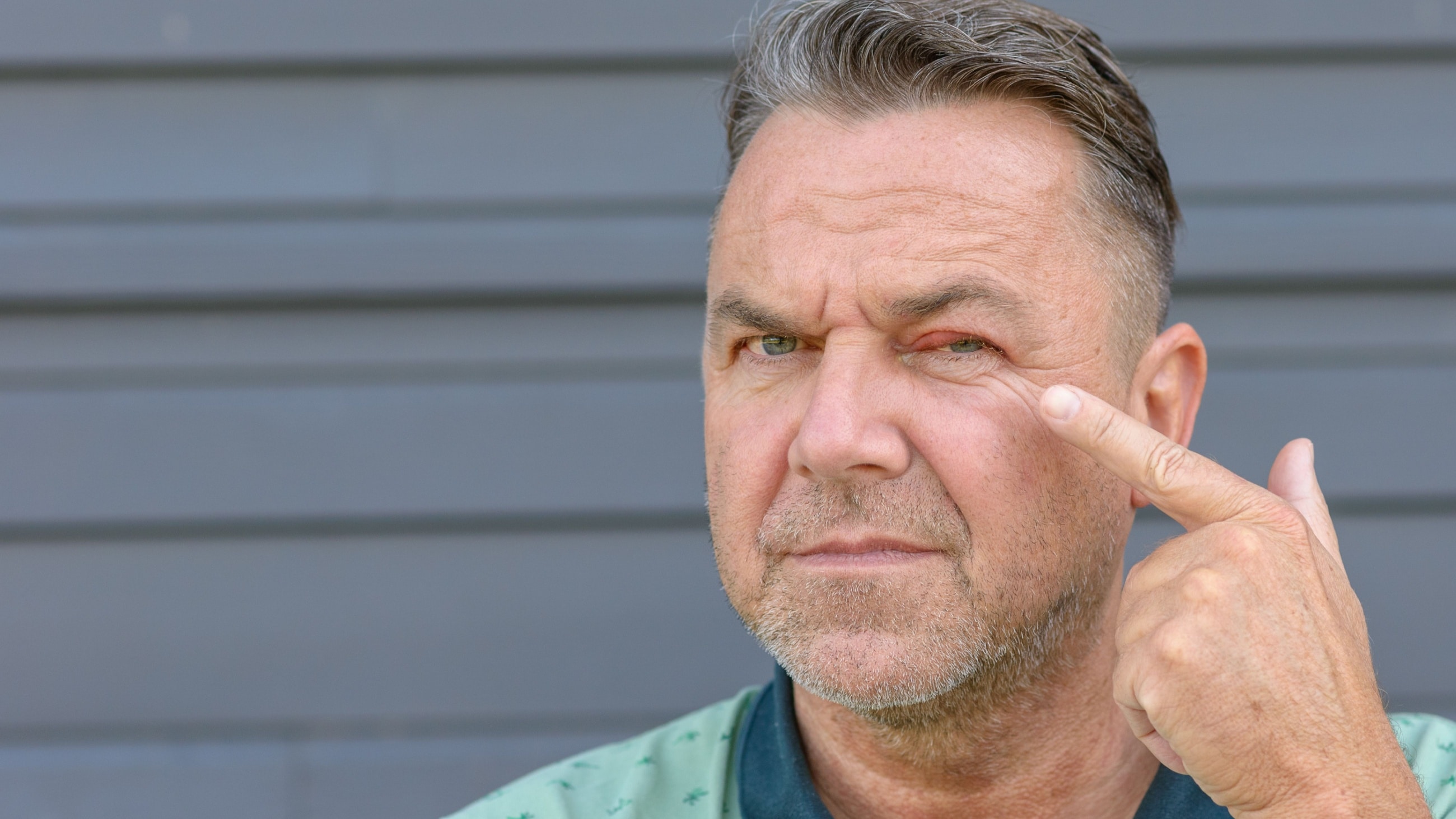A man looks unhappy as he points to a bump on his eyelid. A man looks unhappy as he points to a bump on his eyelid.