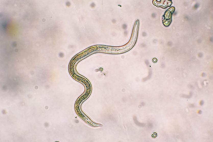 Toxocariasis parasite