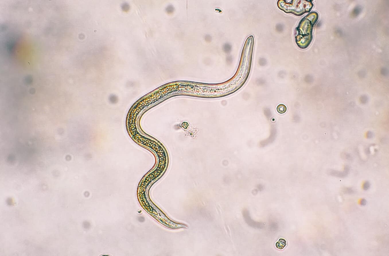 Toxocariasis