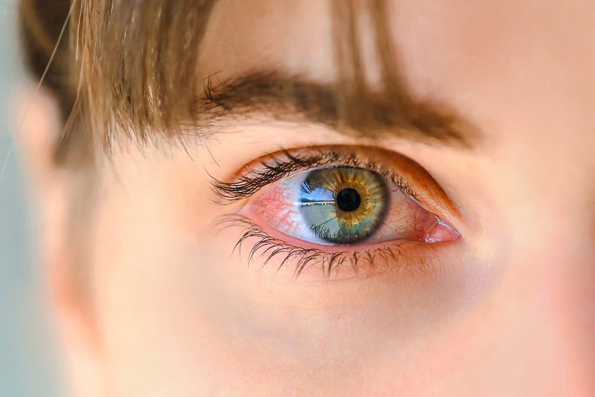 Close-up of woman's pink eye.