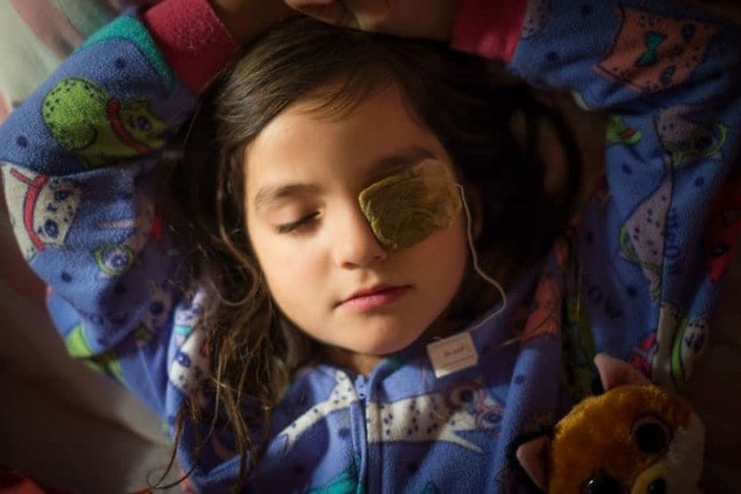 A young brunette girl in pajamas lies back with a warm tea bag over her eye stye. A young brunette girl in pajamas lies back with a warm tea bag over her eye stye.