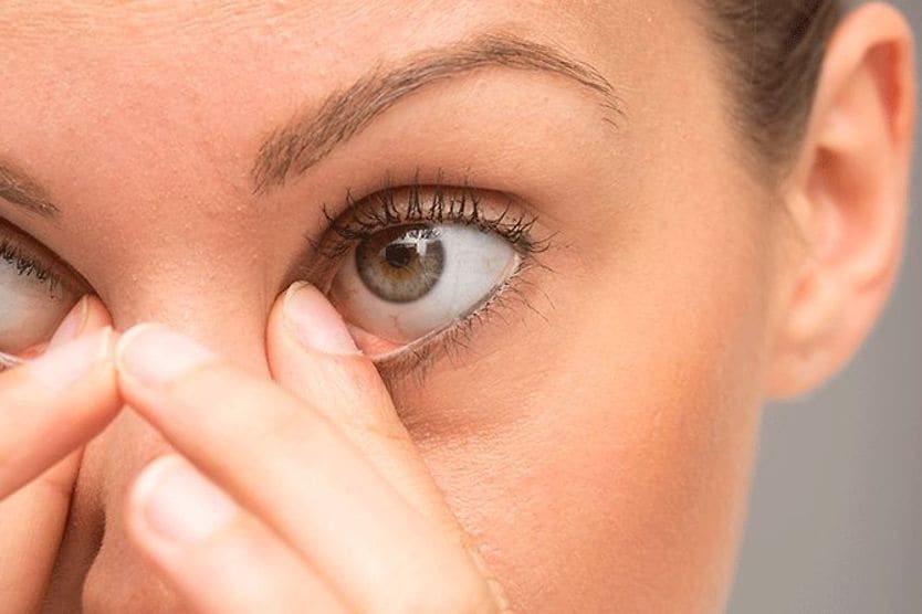 woman wiping away her eye boogers