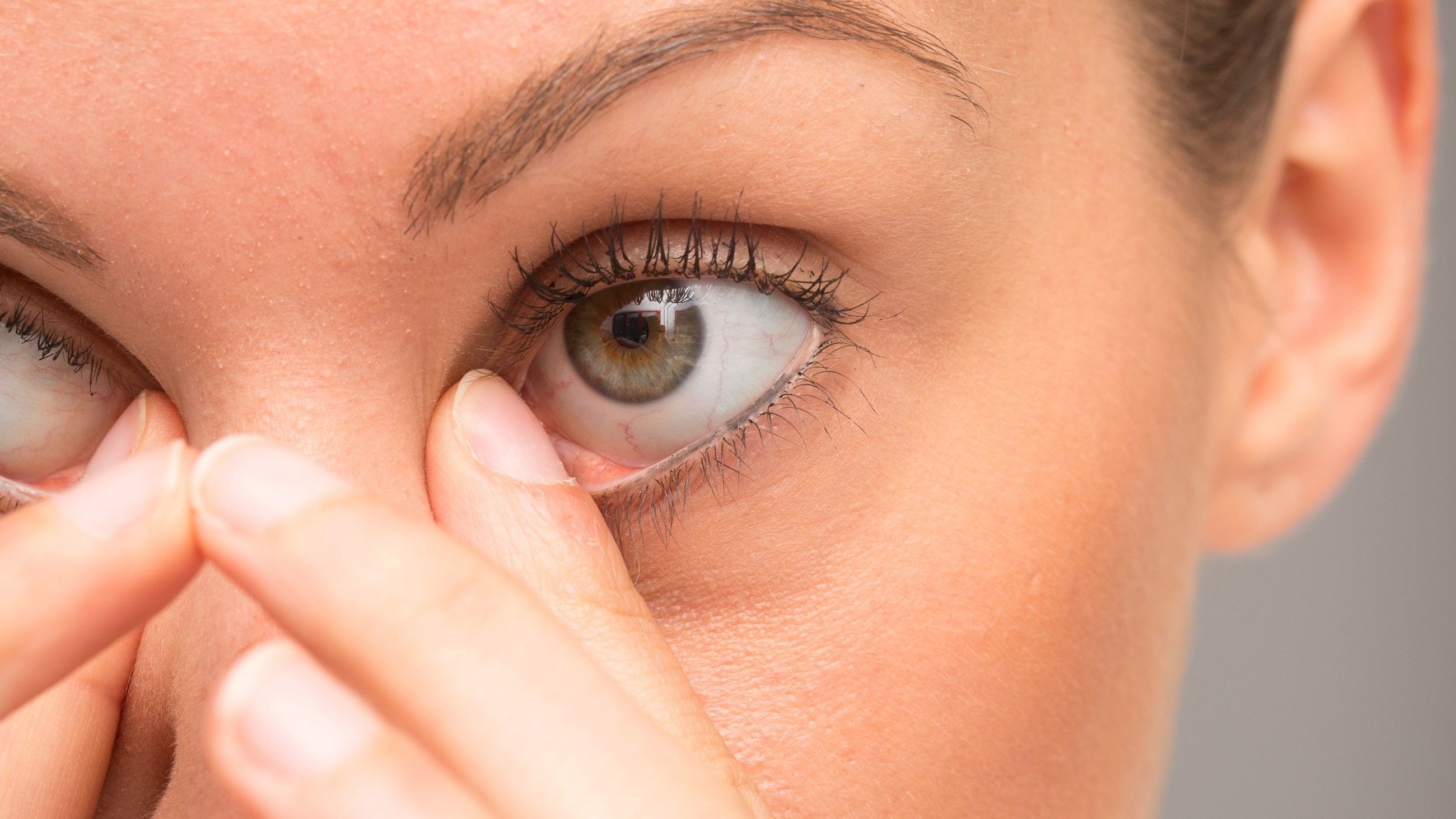 What are eye boogers? What are eye boogers?