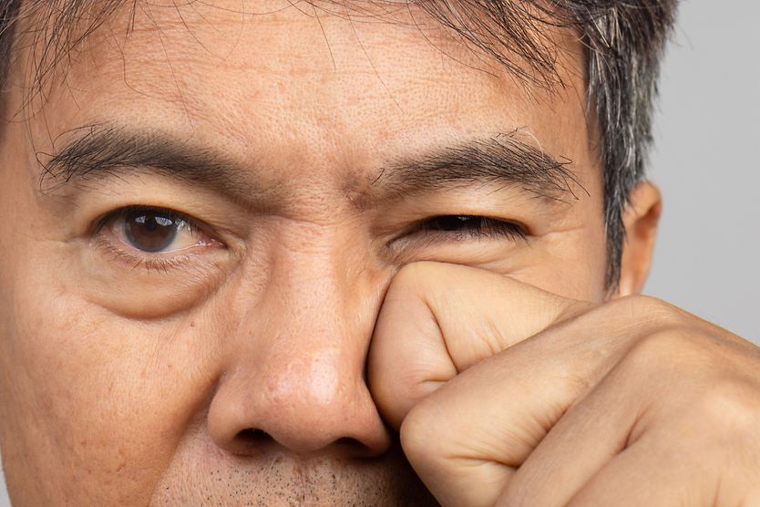 Woman rubbing her eyes to deal with eyelid twitching