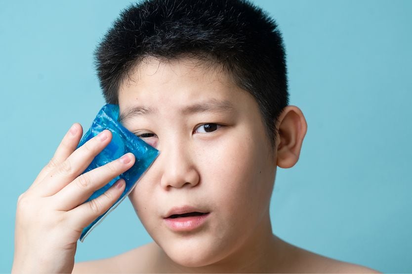 Boy treating his swollen eyelid with a cold compress