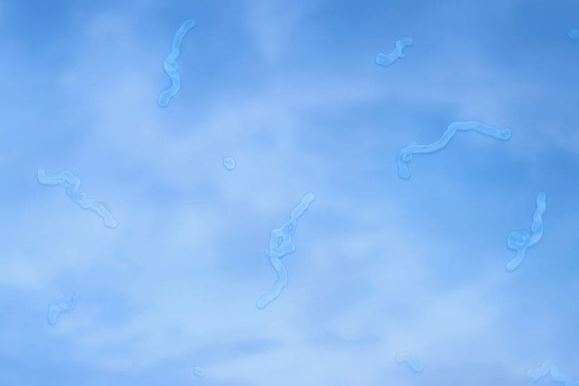 eye floaters view