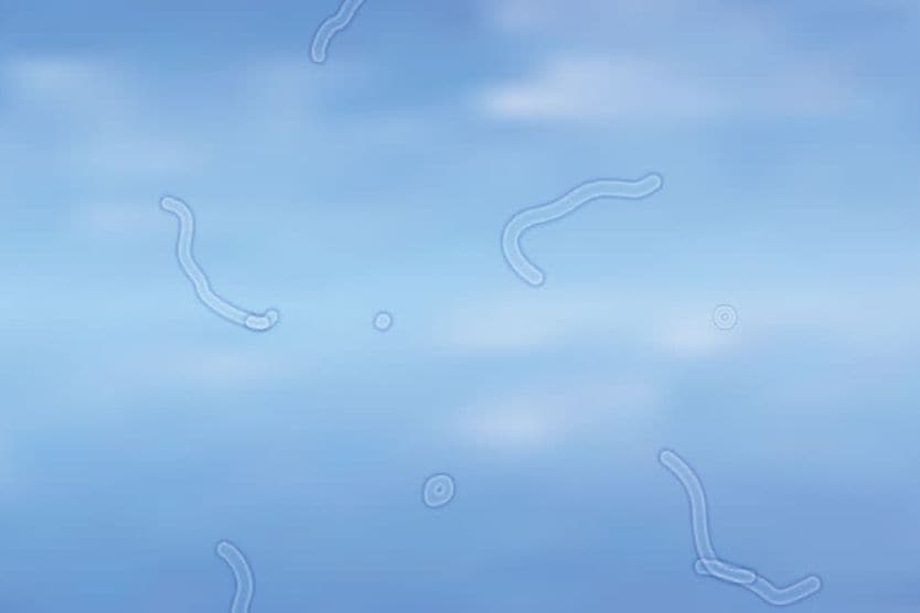 eye floaters view