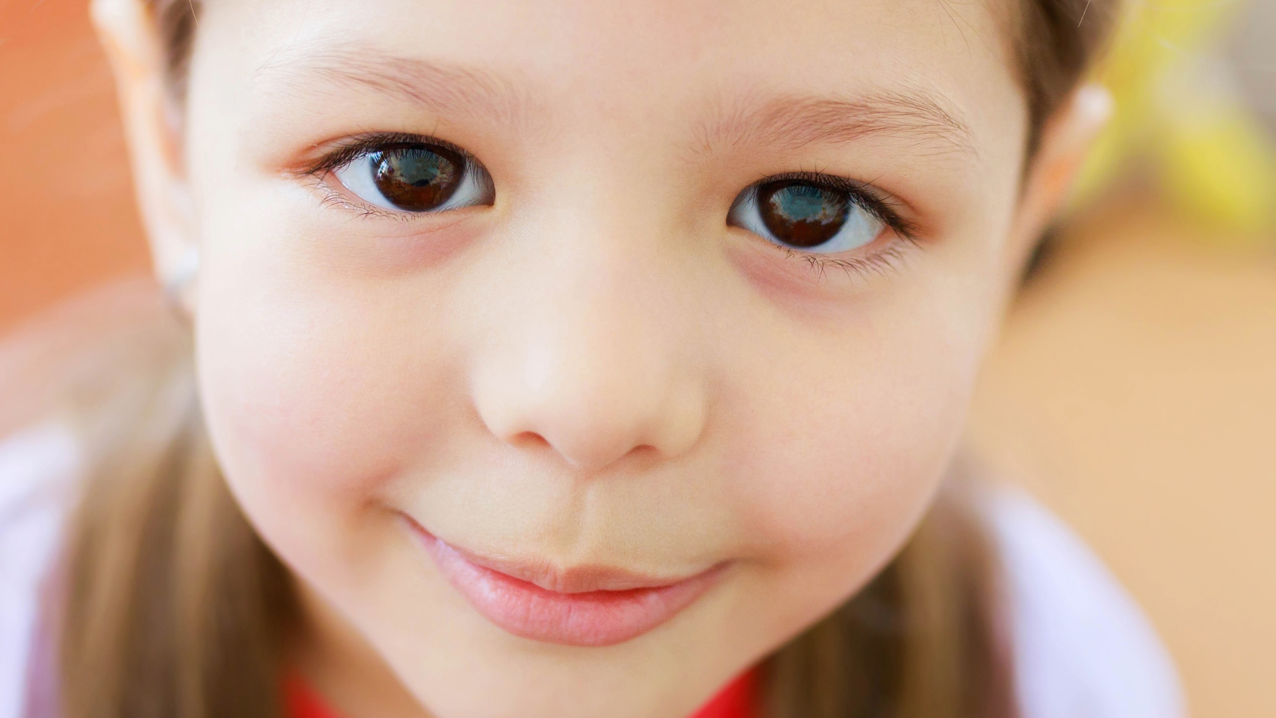 Axenfeld-Rieger syndrome Axenfeld-Rieger syndrome