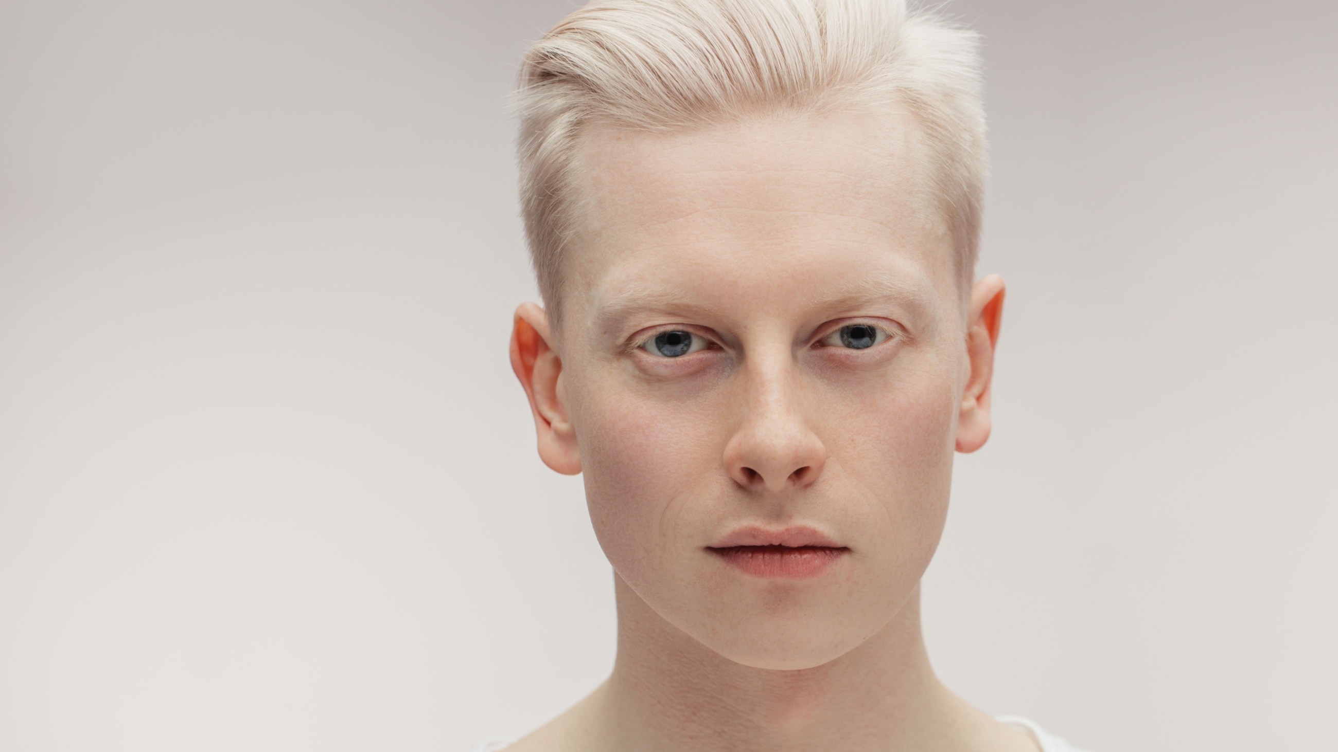 man with albinism