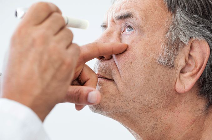 What is ophthalmoplegia? What is ophthalmoplegia?