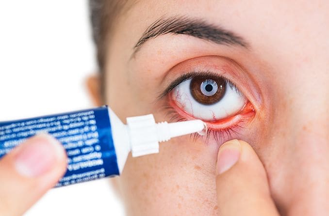 Erythromycin eye ointment: Uses, side effects and more