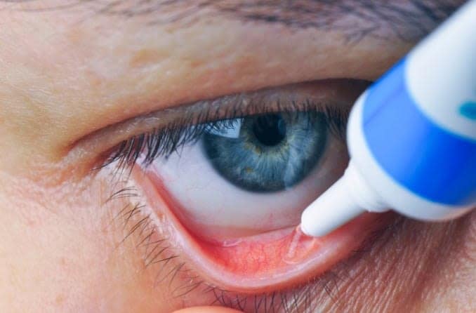 Ophthalmic ointment definition and uses Ophthalmic ointment definition and uses