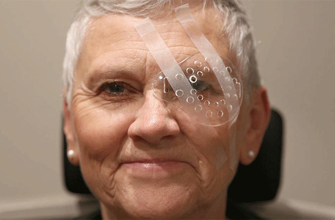 Cataract surgery recovery: 8 tips to minimize recovery time