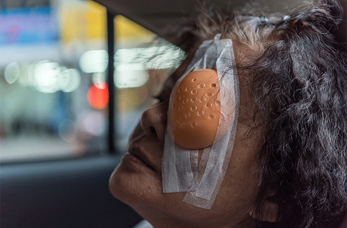 woman in a car after having cataract surgery