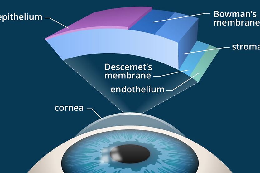 illustration: cross-section of the cornea