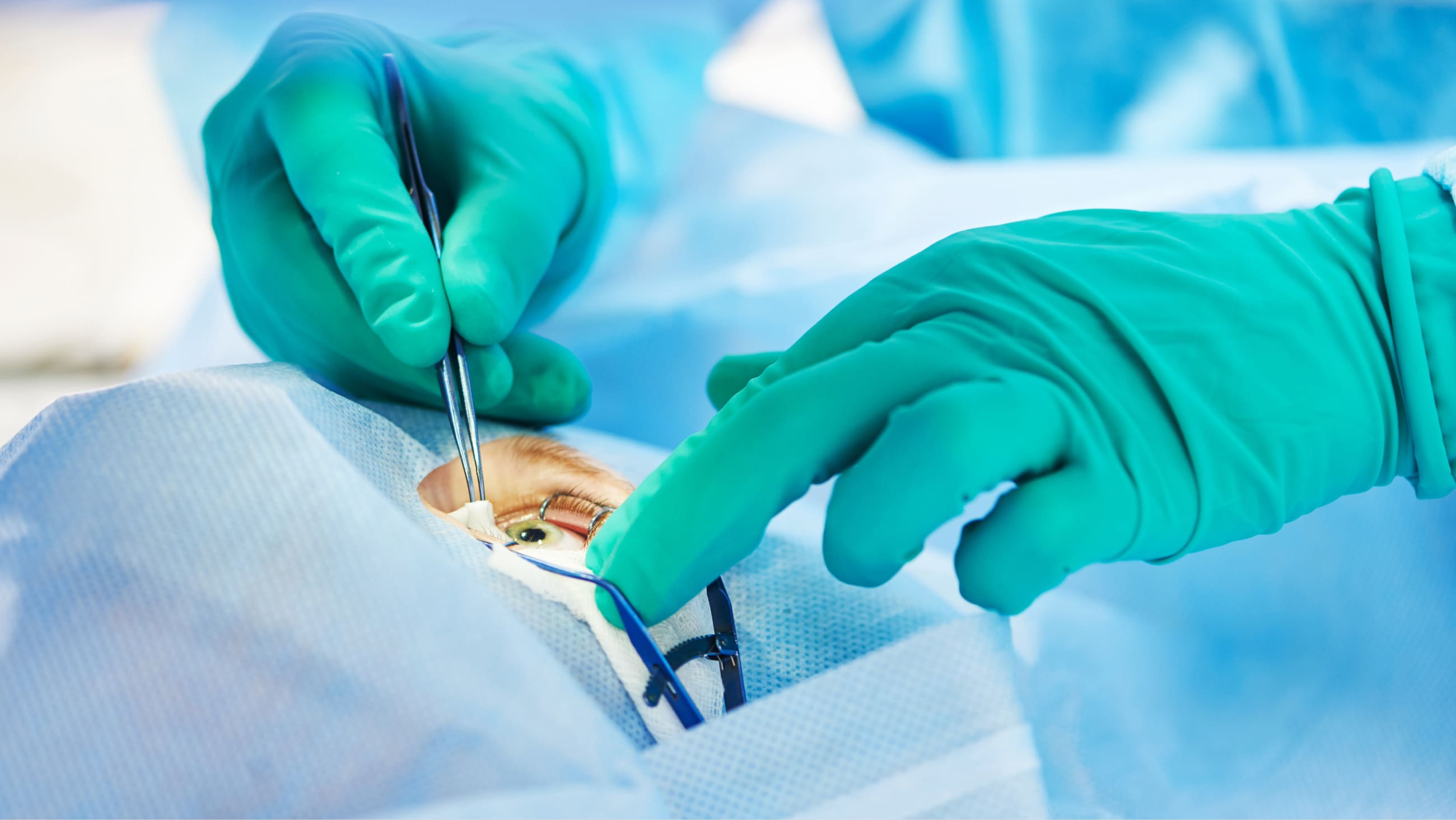 Refractive lens exchange (lens replacement surgery) Refractive lens exchange (lens replacement surgery)