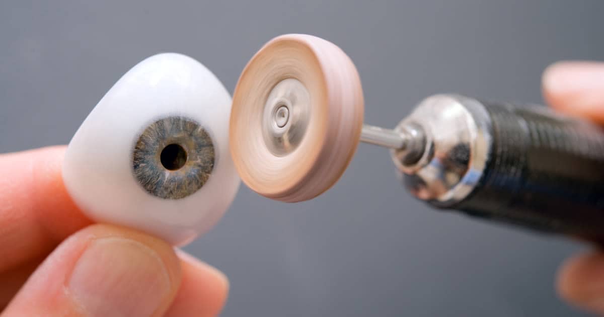 Losing an eye: Enucleation and prosthetic eye FAQ Losing an eye: Enucleation and prosthetic eye FAQ