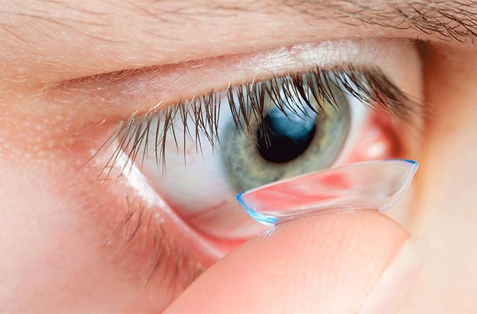 Scleral GP contact lenses: How these can help you