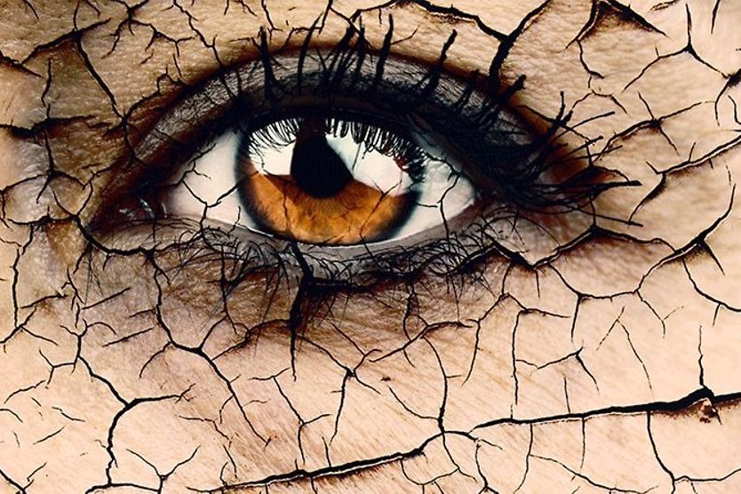 closeup of a dry eye with dry cracked skin and eye overlay closeup of a dry eye with dry cracked skin and eye overlay