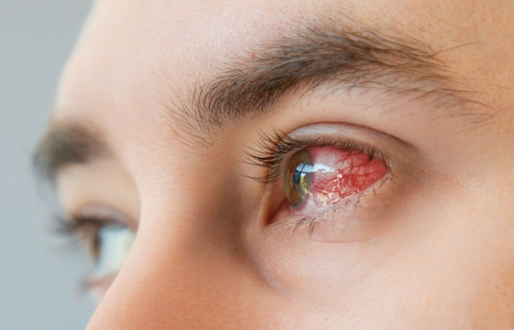 Behçet's disease: Symptoms, causes and treatment