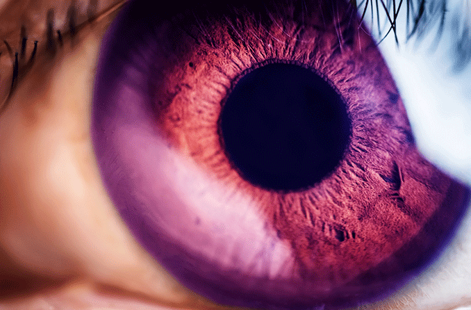 Ojos violetas - All About Vision