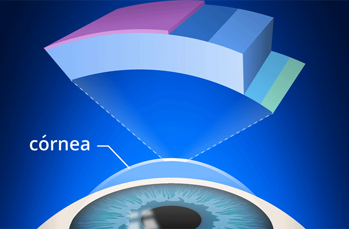 Distrofia corneal de Fuchs: Causas, síntomas, riesgo y tratamientos