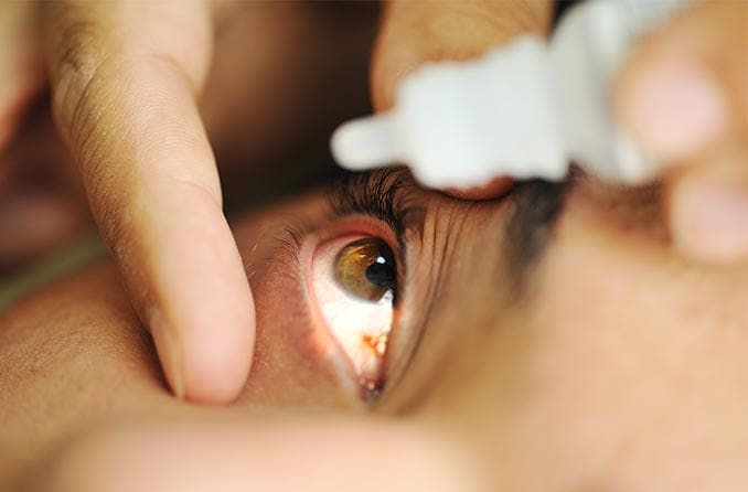 Tratamiento del glaucoma: Colirios y medicamentos | All About Vision