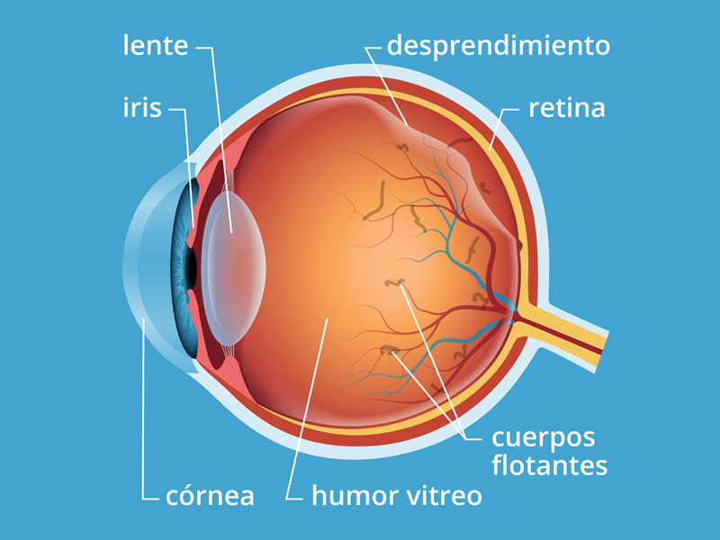 Mideosopsias o moscas en los ojos | All About Vision